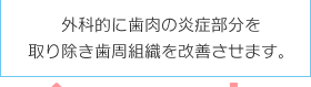 外科的に歯肉の炎症部分を取り除き歯周組織を改善させます。