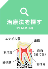 治療法を探す